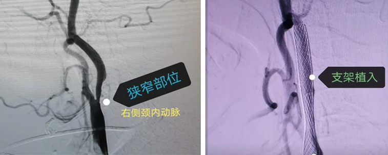 1612162682956978.png 微信图片_20210201145752.png